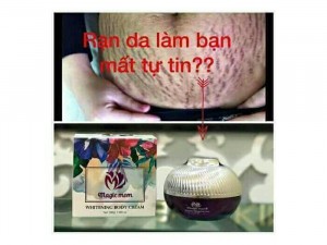 Kem ngừa rạn dưỡng da