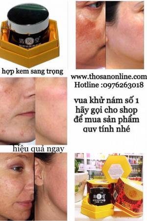 Nám da thường xuất hiện ở độ tuổi trung niên đặc biệt tập trung ở hai bên má, trán, mũi. Nguyên nhân gây nám có thể là do yếu tố di truyền, sự thay đổi nội tiết tố (mang thai, mãn kinh), do các bệnh phụ khoa như viêm nhiễm, viêm tử cung..., stress, yếu tố môi