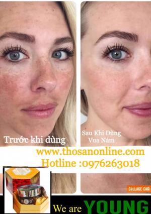 – Loại bỏ các hắc tố đen nám, tàn nhang
– Ngăn ngừa các vết thâm ở mặt và vùng cổ
– Đặc biệt trong kem có chứa nhiều chất đặc trị để phục hồi da nhanh chống. Giúp da trở nên tươi sáng, trắng hồng, mịn màng.