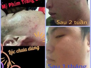 Serum Ủ Face Cao Cấp Trang Bon