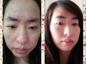 Serum Ủ Face Cao Cấp Trang Bon