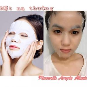 Mặt nạ nhau thai cừu Hàn Quốc có trị được nám da không?
