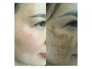 Vua khử nám nhật bản
