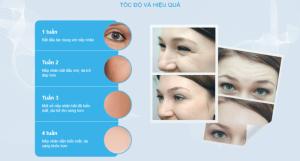 Serum Inno Gialuron chống lão hóa làm mờ nếp nhăn