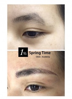 Điêu Khắc Chân Mày 8D Tự Nhiên Ở Springtime Spa Clinic Quận 1