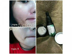 SERUM Tảo Biển