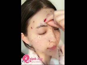 Đặt Hàng ngay
Quỳnh Nga
SĐT: 0944 024 245
Địa chỉ: số 202, ngõ 147A/60 Tân Mai, Hà Nội
Tên giao dịch: quynhngashop.com