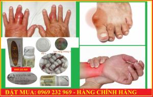 Linsen double caulis plus Hỗ trợ trị Gút ( Gout ) - Malaysia