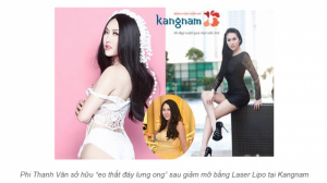 Hút mỡ bụng bằng laser lipo 3