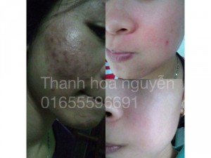 Combo mỹ phẩm đông y thanh trang
