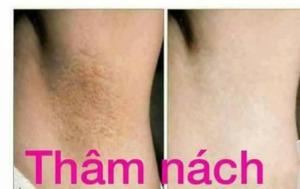 Serum Nụ Hồng
