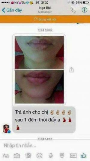 Serum Nụ Hồng