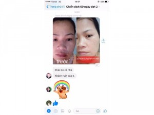 Kem Trị Nám Linh Nhâm