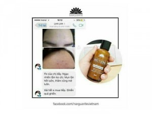 Nhũ Tương chuyên trị mụn và da dầu