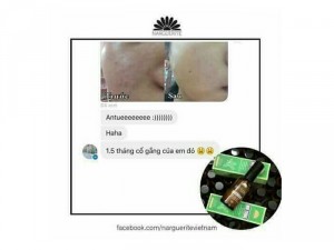 Nhũ Tương chuyên trị mụn và da dầu