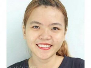 Kem sau dị ứng phục hồi da hư tổn