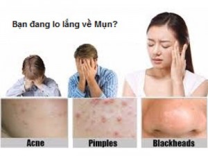Máy Hút Mụn Cầm Tay 3 Chế Độ