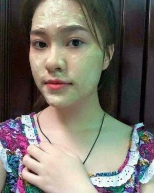 Bột cám gạo thảo dược Anthy hỗ trợ điều trị mụn