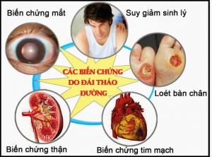 Địa chỉ mua bán dây thìa canh uy tín chất lượng nhất đảm bảo khi sử dụng