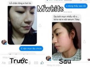 Kem trị mụn mwhite (Siêu phẩm trị mụn dành cho da mặt)