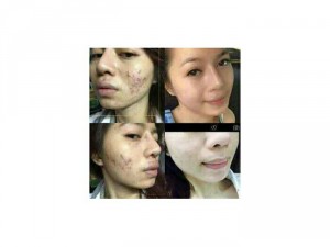 Kem Chấm Mụn SPL Princess_white