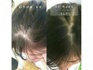 Túi lọc gội đầu thiên nhiên