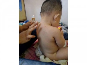 serum thảo dược kiều