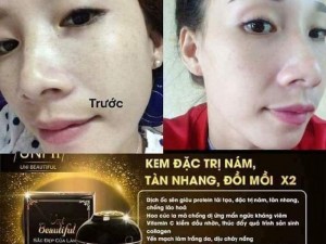 Kem đặc trị nám- tàn nhang- đồi mồi