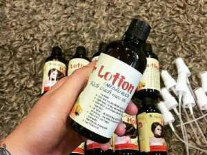Dưỡng kích thích mọc tóc