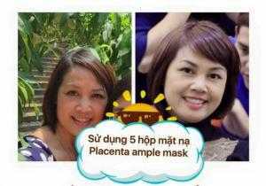 Mua mặt nạ nhau thai cừu ở đâu?