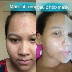 Mặt Nạ Nhau Thai Cừu Bán Ở Đâu?