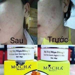 trước và sau khi khách sử dụng