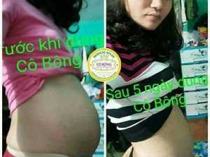Kem tan mỡ Cô Bông