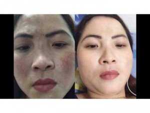 Bước sang tuổi 30 da mặt chúng ta bắt đầu xuất hiện những dấu hiệu của lão hoá