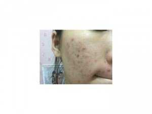 Sắc dược thảo mộc thiên nhiên