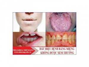 Hỗ trợ Răng miệng TKH