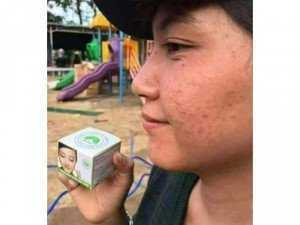 Trị mụn tận gốc TRẦN KIM HUYỀN