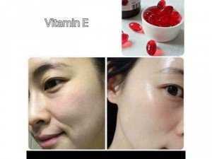 Vitamin E Nga