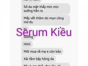 Serum kiều beauty queen ( chính hãng)