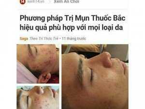 Trị mụn tái tạo da