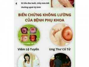 Hỗ trợ bệnh phụ nữ