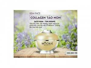 SẢn phẩm kem trị nám Mocha