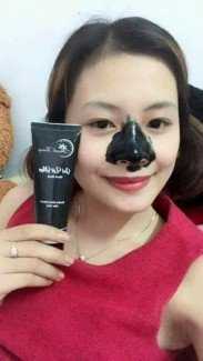 Gel lột mụn Thanh Trang