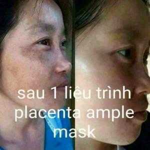 Mặt nạ Nhau thai cừu