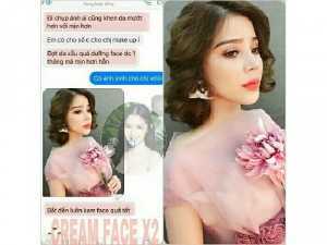 Kem Facex2 trị mụn,dưỡng trắng cấp tốc