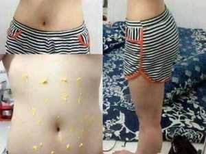 Kem tan mỡ