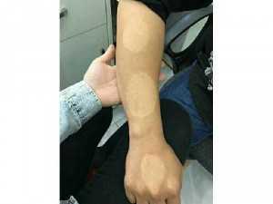 Tắm trắng thảo mộc hot