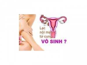 Băng vệ sinh avail beauty