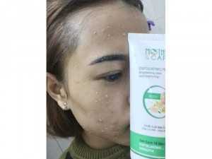 Tẩy tế bào chết