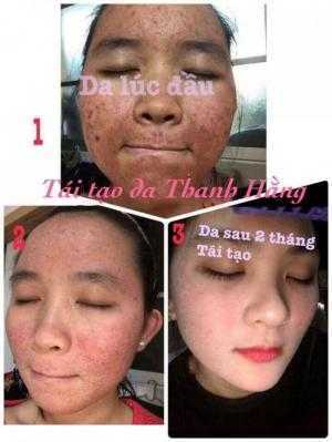Ảnh thật của khách hàng trước và sau khi sử dụng sản phẩm